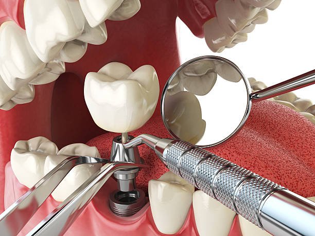 Best Holiday Emergency Dentist in Blanchester, OH